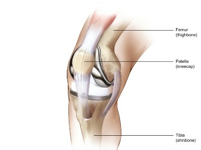 knee-implant1.jpg